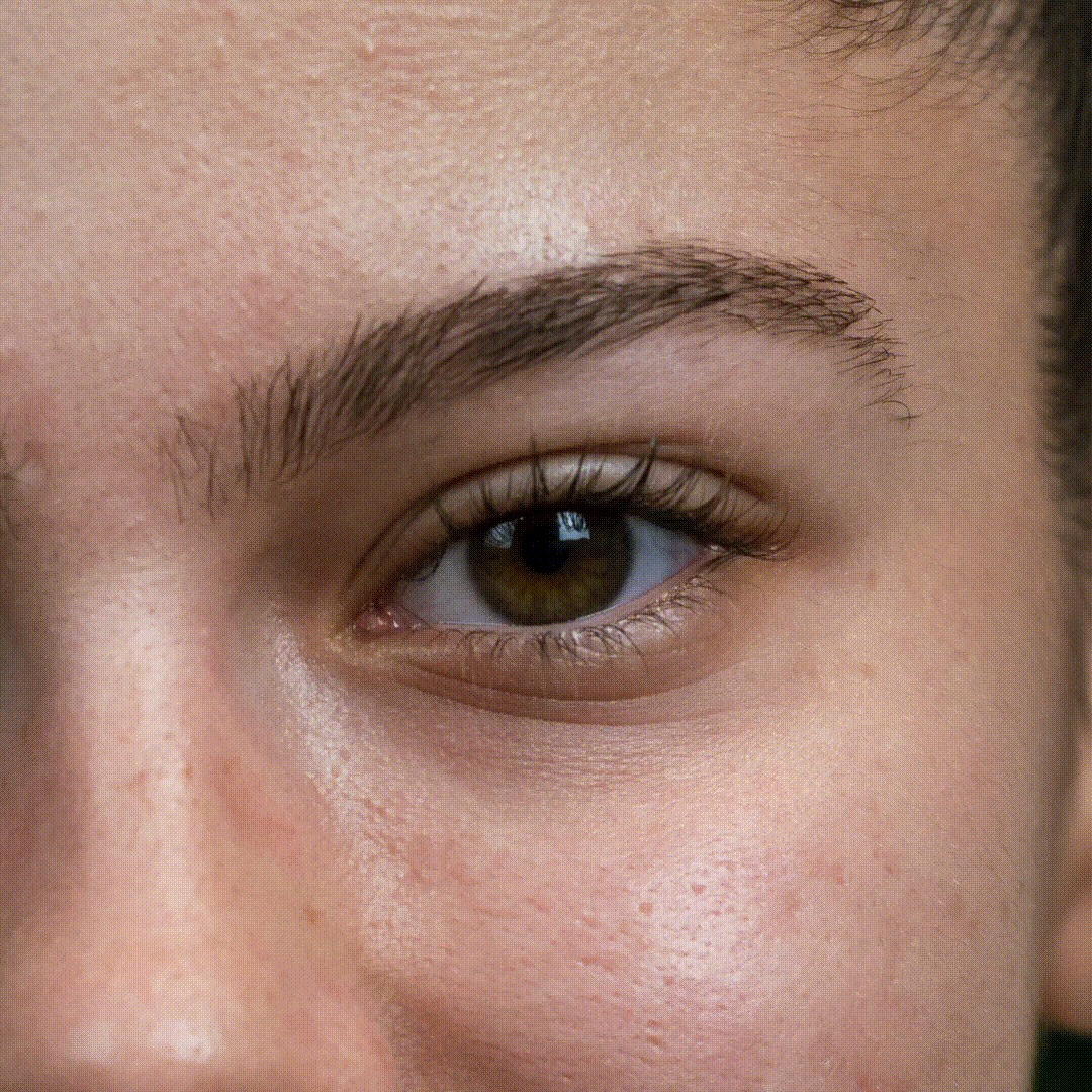 Трансформация мигли